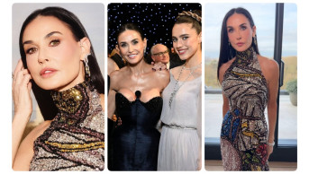 Famous Ears: How Celebrities Embrace Their Unique Features