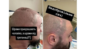 Victor Rozovyi's Resilience: A Journey of Healing and Courage